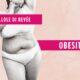 Obesità