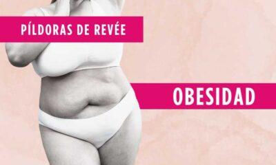 Obesidad