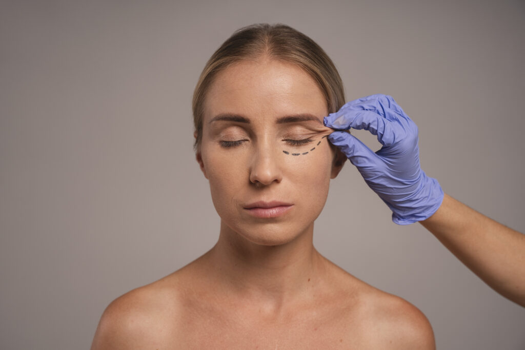 oculoplastica